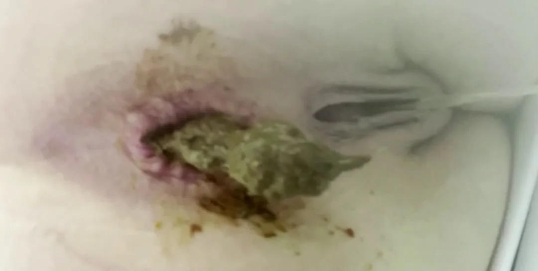The Fart Babes - Shit Latest Uploads, Shitting, Scatting