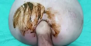 Download Casal Fist - Hand in the shit ass and a lot of scat, Play Dirty Anal, Fisting ShitWorld.net