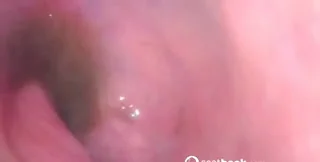 Sweet Tinqerbell - Endoscope In My Ass, Dirty Anal, Toy