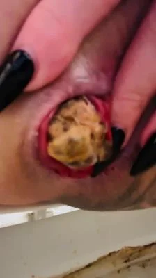 Look at that prolapse! UltraHD 4K / 45.5 MB Download / Online