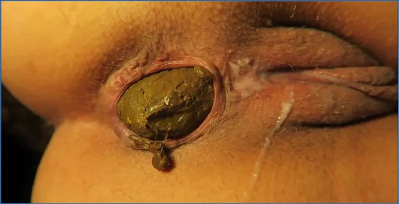Download A Dreamy Fecal Fiesta - Love Rachelle in LoveRachelle2 - Zoompoo After Fuck ShitWorld.net