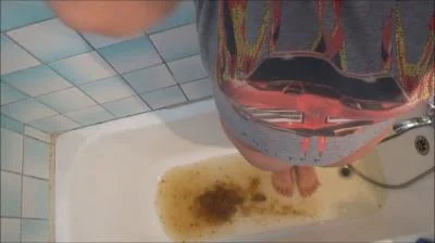 Watch Shitting Urge And Enema SD / 377 MB Online