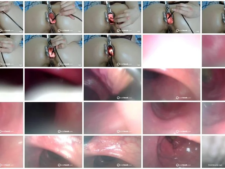 Watch Gape With Speculum FullHD 1080p / 118 MB Online